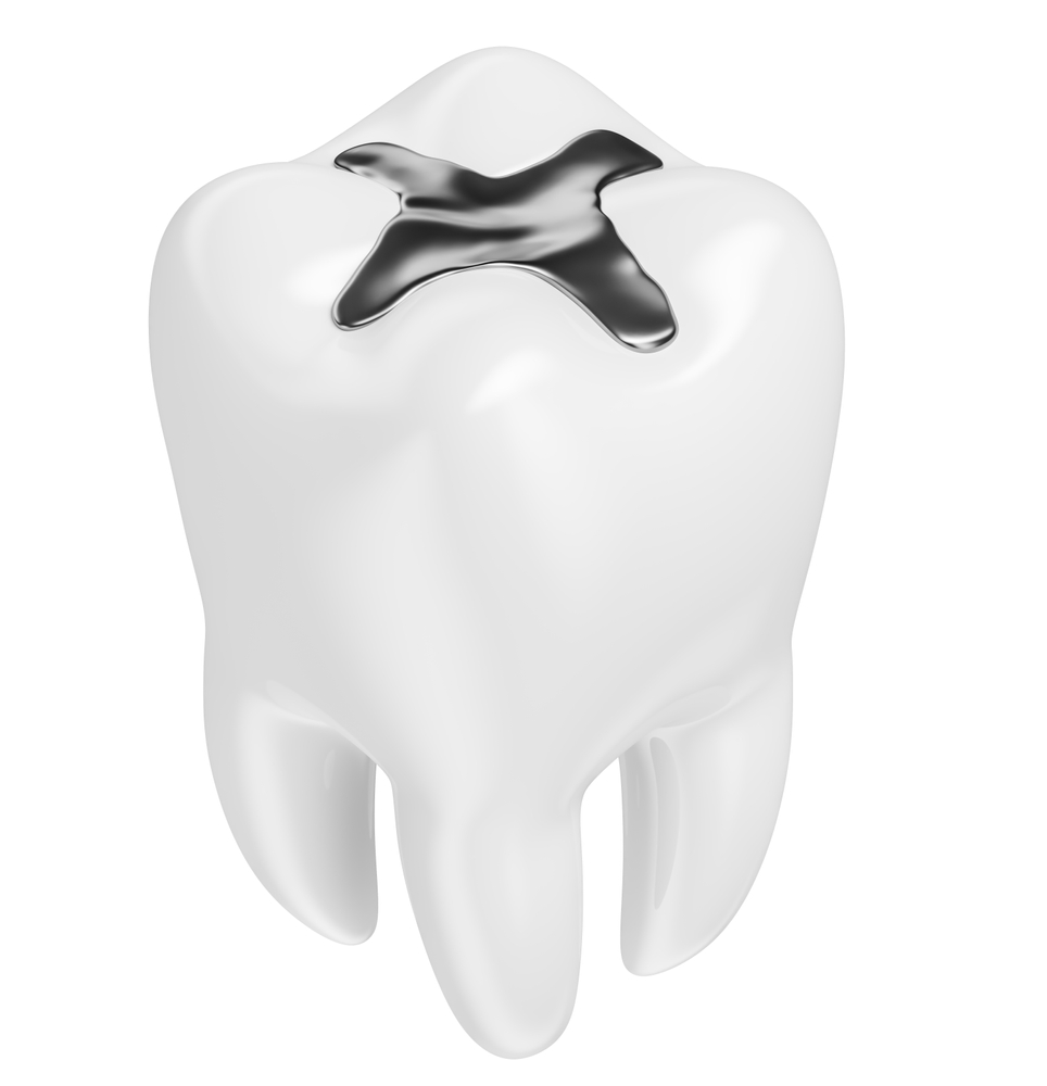 does silver diamine fluoride turn teeth black
