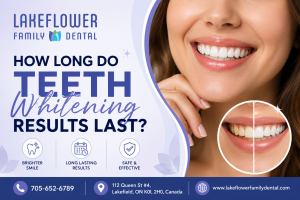 how long do teeth whitening results last